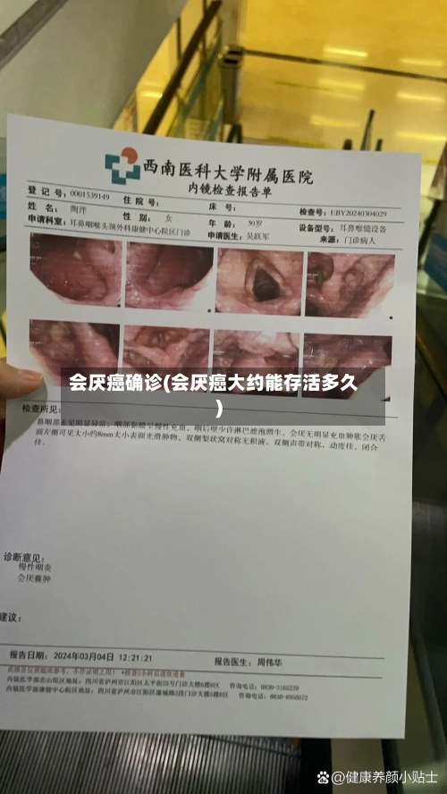 会厌癌确诊(会厌癌大约能存活多久)
