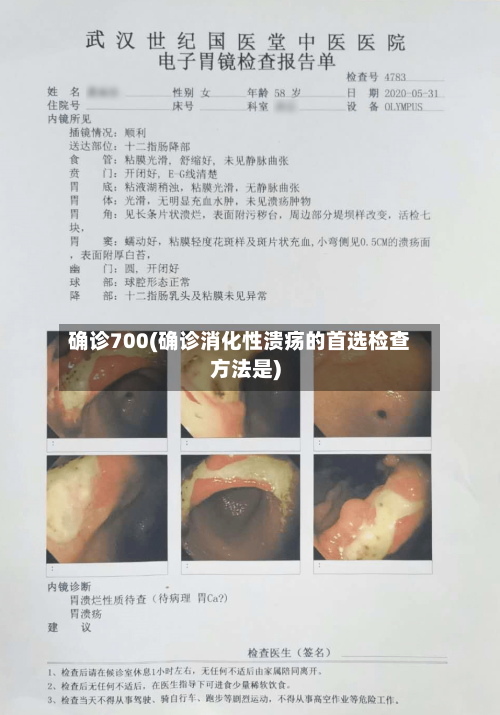 确诊700(确诊消化性溃疡的首选检查方法是)-第2张图片