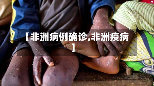 【非洲病例确诊,非洲疫病】-第3张图片