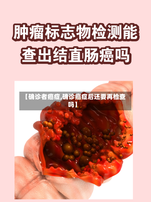 【确诊者癌症,确诊癌症后还要再检查吗】-第3张图片