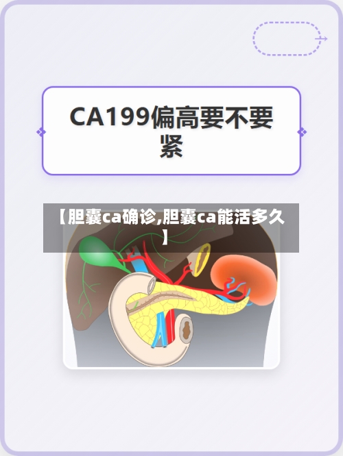 【胆囊ca确诊,胆囊ca能活多久】