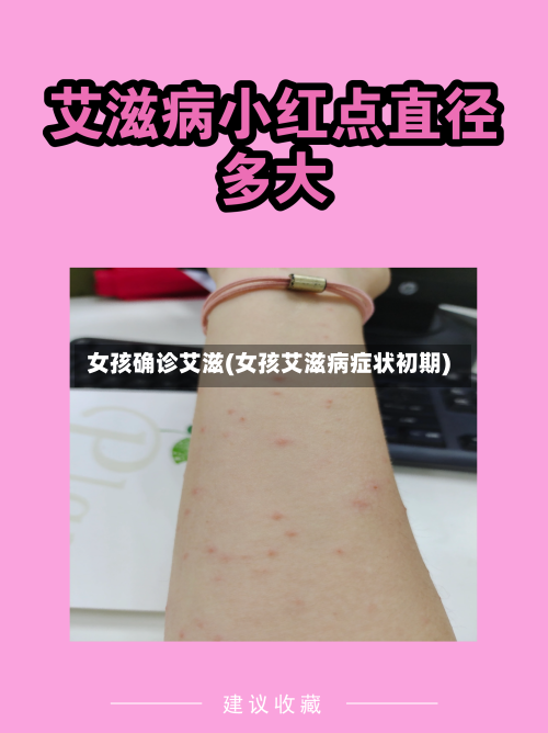 女孩确诊艾滋(女孩艾滋病症状初期)-第3张图片