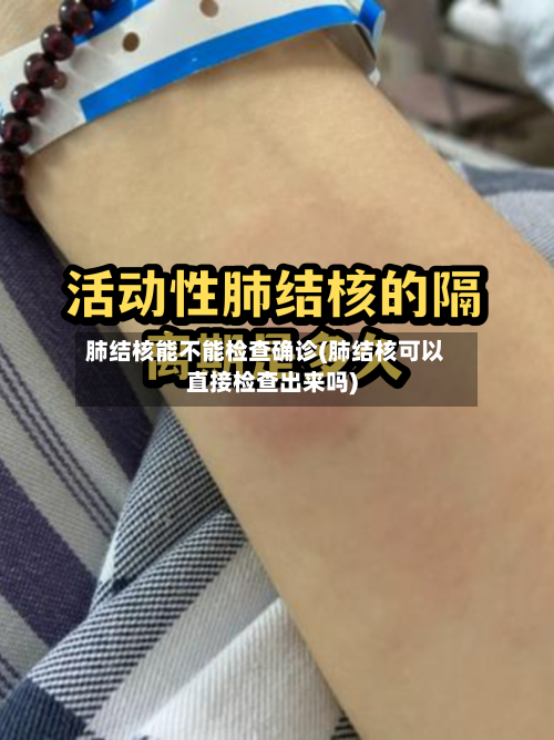 肺结核能不能检查确诊(肺结核可以直接检查出来吗)