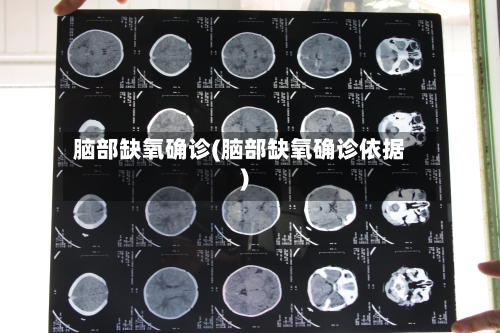 脑部缺氧确诊(脑部缺氧确诊依据)-第3张图片