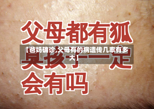 【爸妈确诊,父母有的病遗传几率有多大】-第2张图片