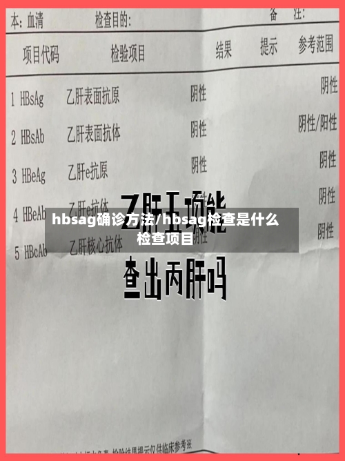 hbsag确诊方法/hbsag检查是什么检查项目