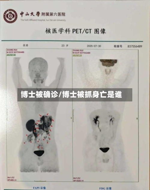 博士被确诊/博士被抓身亡是谁