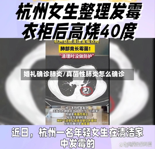 婚礼确诊肺炎/真菌性肺炎怎么确诊