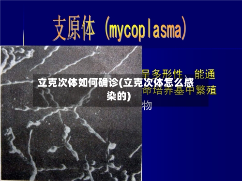 立克次体如何确诊(立克次体怎么感染的)-第2张图片
