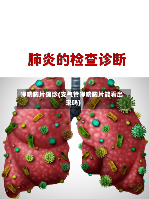 哮喘胸片确诊(支气管哮喘胸片能看出来吗)