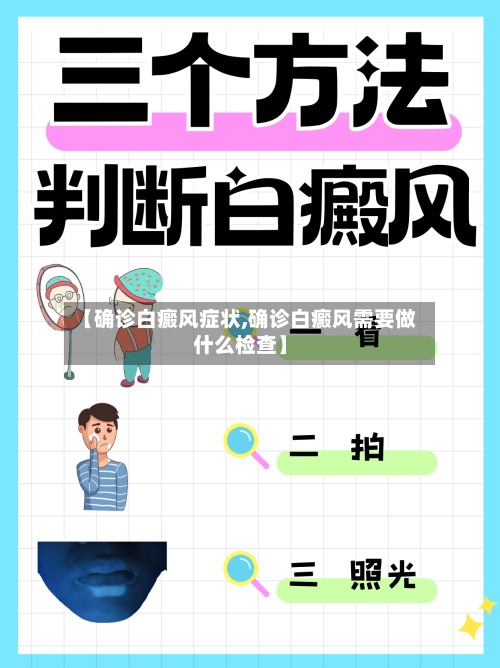 【确诊白癜风症状,确诊白癜风需要做什么检查】-第2张图片