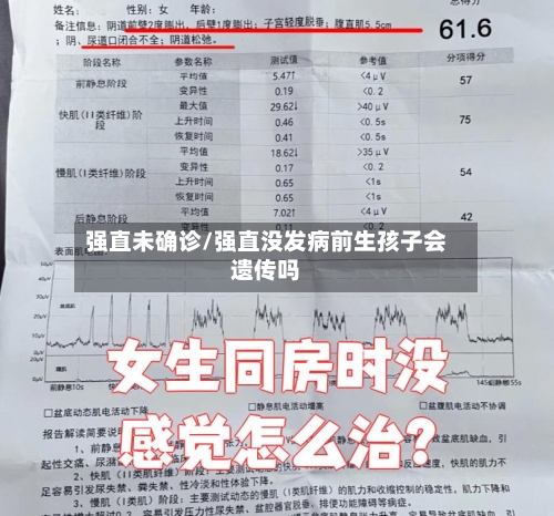 强直未确诊/强直没发病前生孩子会遗传吗