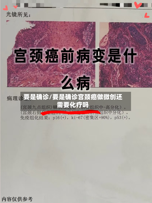 要是确诊/要是确诊宫颈癌做微创还需要化疗吗-第3张图片