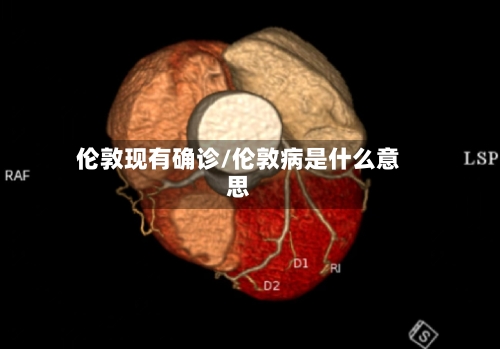 伦敦现有确诊/伦敦病是什么意思