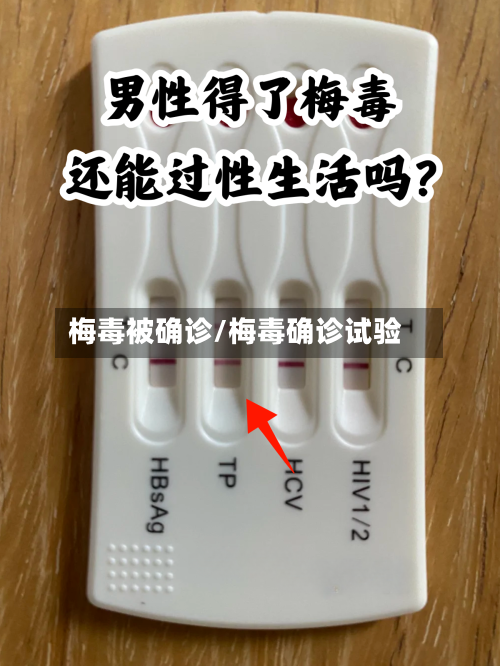 梅毒被确诊/梅毒确诊试验-第3张图片