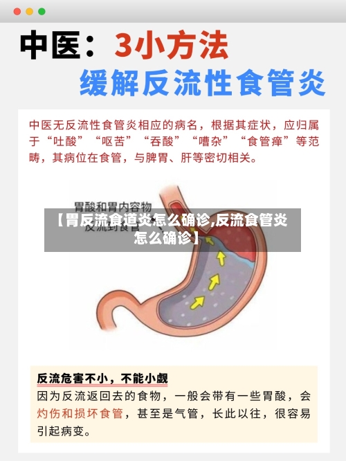 【胃反流食道炎怎么确诊,反流食管炎怎么确诊】-第2张图片