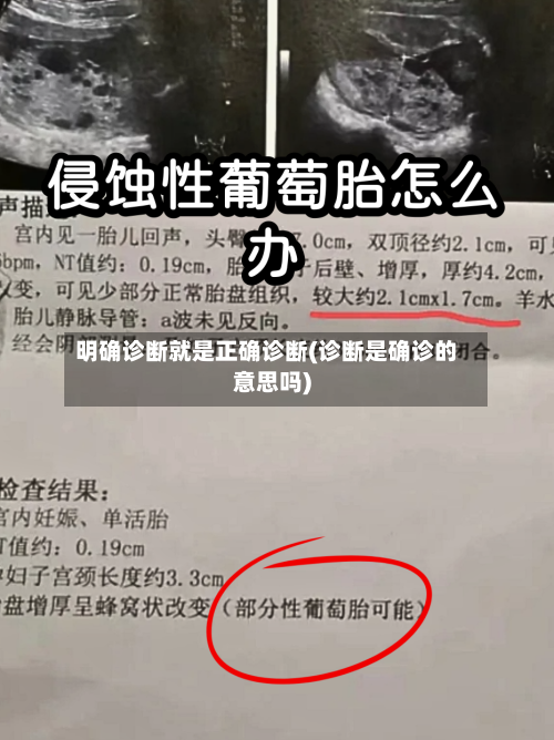 明确诊断就是正确诊断(诊断是确诊的意思吗)