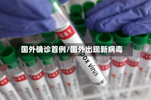 国外确诊首例/国外出现新病毒-第3张图片