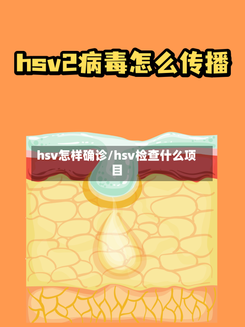hsv怎样确诊/hsv检查什么项目-第3张图片