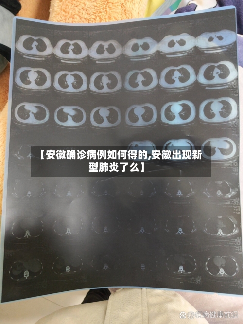 【安徽确诊病例如何得的,安徽出现新型肺炎了么】
