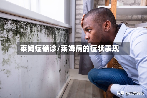莱姆症确诊/莱姆病的症状表现-第2张图片
