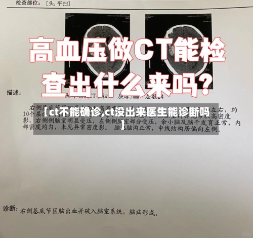 【ct不能确诊,ct没出来医生能诊断吗】-第2张图片