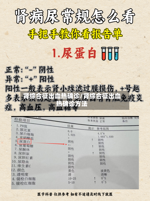肾综合征出血热确诊/肾综合征出血热确诊方法-第2张图片