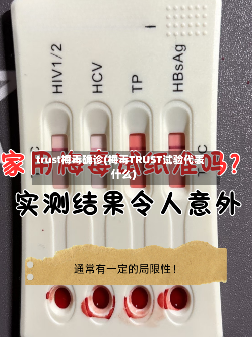 trust梅毒确诊(梅毒TRUST试验代表什么)