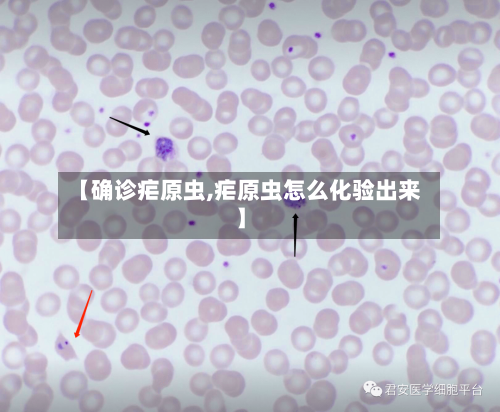 【确诊疟原虫,疟原虫怎么化验出来】-第3张图片