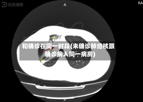 和确诊在同一时段(未确诊肺结核跟确诊病人同一病房)-第2张图片