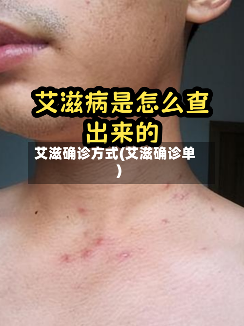 艾滋确诊方式(艾滋确诊单)-第2张图片