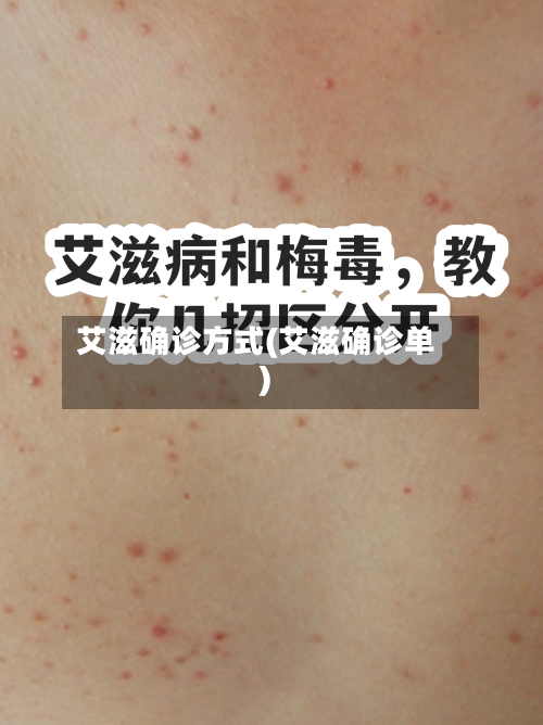 艾滋确诊方式(艾滋确诊单)-第3张图片