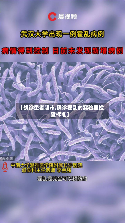 【确诊患者超市,确诊霍乱的实验室检查标准】-第2张图片