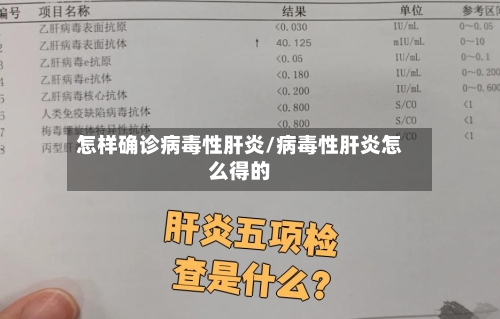 怎样确诊病毒性肝炎/病毒性肝炎怎么得的-第2张图片