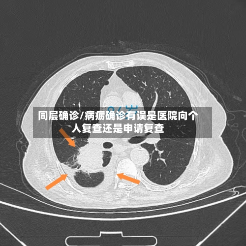 同层确诊/病疬确诊有误是医院向个人复查还是申请复查-第2张图片