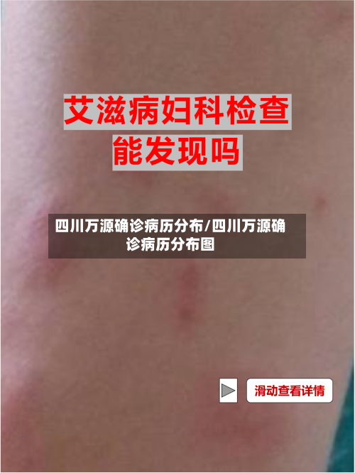 四川万源确诊病历分布/四川万源确诊病历分布图