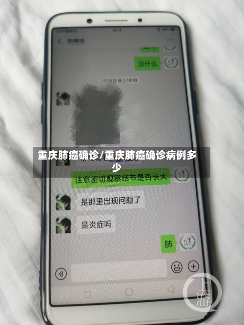 重庆肺癌确诊/重庆肺癌确诊病例多少-第2张图片