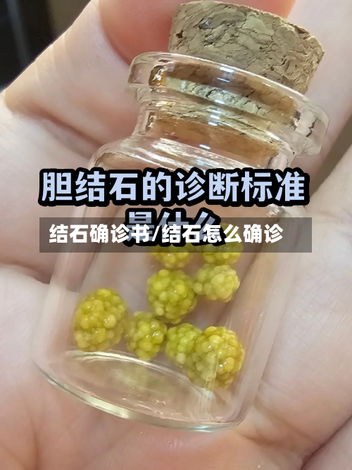结石确诊书/结石怎么确诊-第3张图片