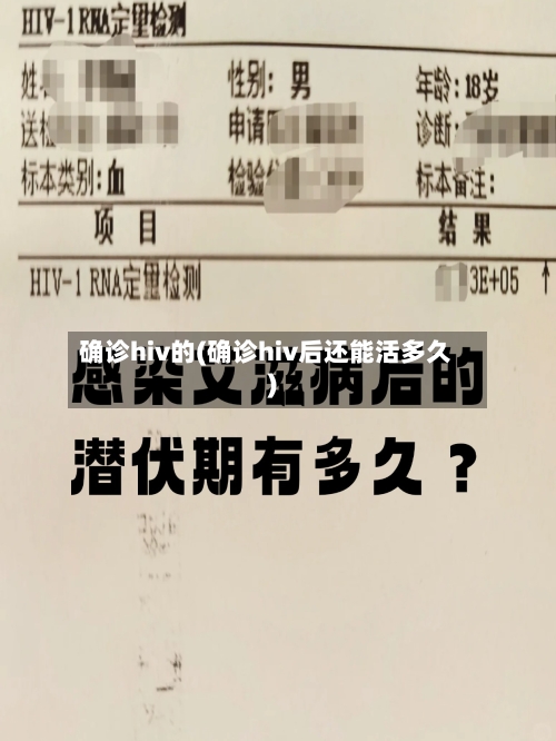 确诊hiv的(确诊hiv后还能活多久)-第2张图片