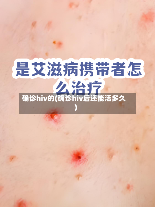 确诊hiv的(确诊hiv后还能活多久)
