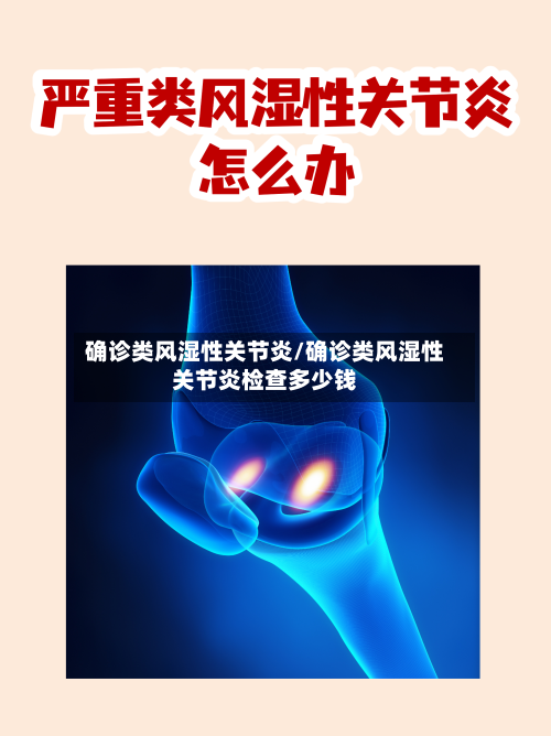 确诊类风湿性关节炎/确诊类风湿性关节炎检查多少钱