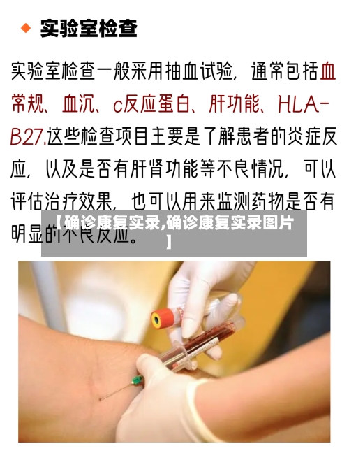 【确诊康复实录,确诊康复实录图片】-第3张图片