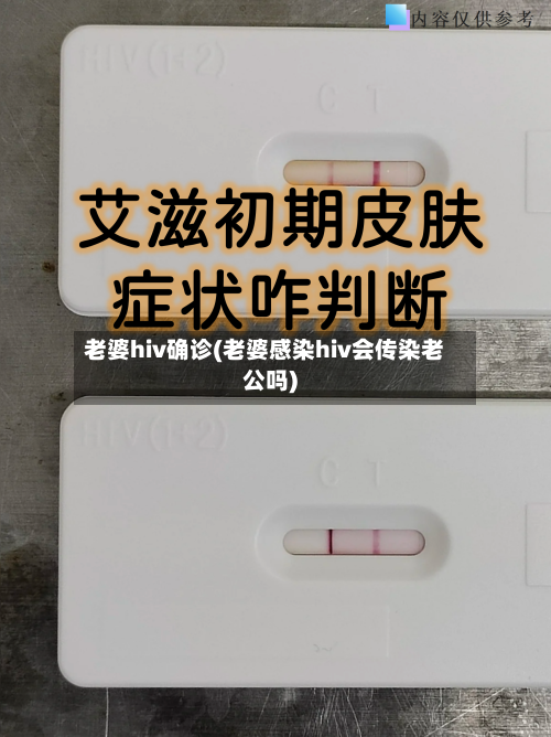老婆hiv确诊(老婆感染hiv会传染老公吗)