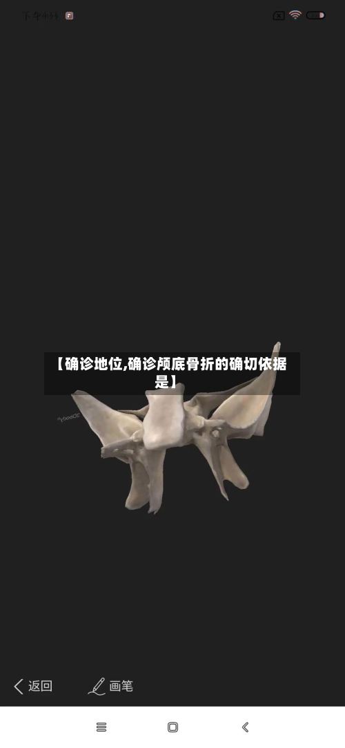 【确诊地位,确诊颅底骨折的确切依据是】-第2张图片