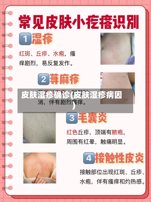 皮肤湿疹确诊(皮肤湿疹病因)