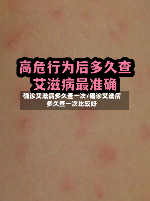 确诊艾滋病多久查一次/确诊艾滋病多久查一次比较好-第3张图片