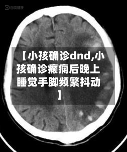 【小孩确诊dnd,小孩确诊癫痫后晚上睡觉手脚频繁抖动】