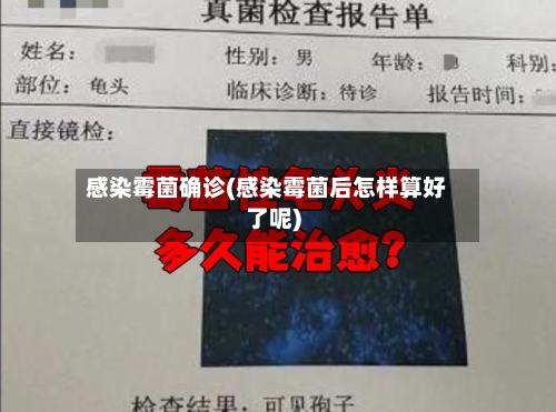 感染霉菌确诊(感染霉菌后怎样算好了呢)-第2张图片