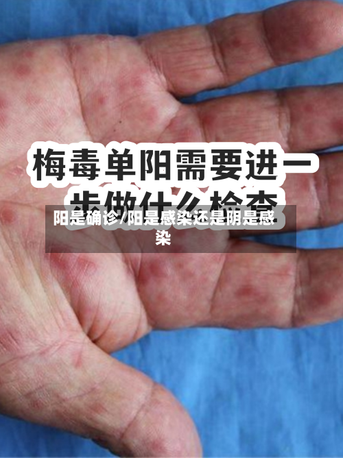 阳是确诊/阳是感染还是阴是感染