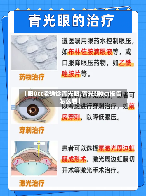 【眼0ct能确诊青光眼,青光眼0ct报告怎么看】-第2张图片